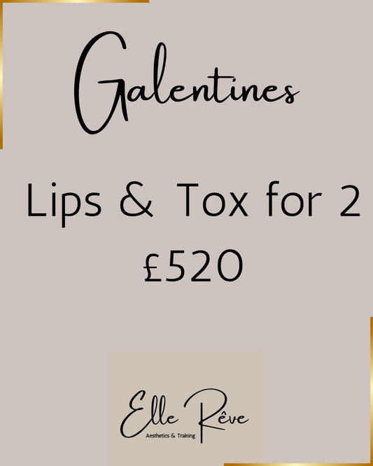 Galentines offer